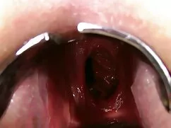 Nóng, xxx mbbg ở giữa